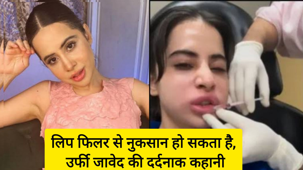 उर्फी जावेद का लिप फिलर अनुभव बना दर्दनाक सबक। जानें कैसे खूबसूरती की चाह उनके चेहरे और आत्मविश्वास पर भारी पड़ी, और क्यों लिप फिलर के साइड इफेक्ट्स को हल्के में लेना खतरनाक हो सकता है।
